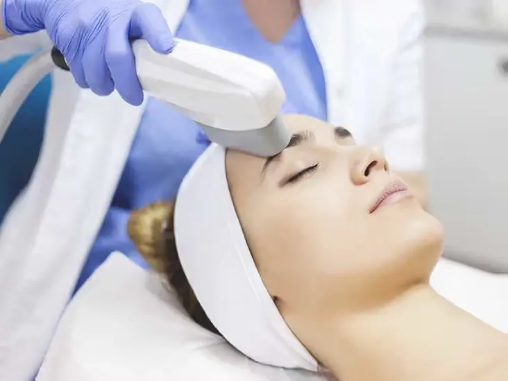 IPL treatment with the Viora V30 platform